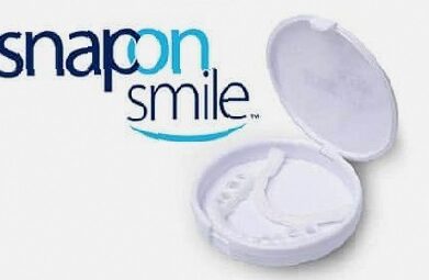 Snap-on Smile - Ce este